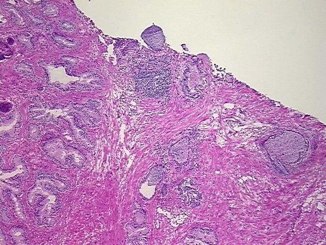 4x Image