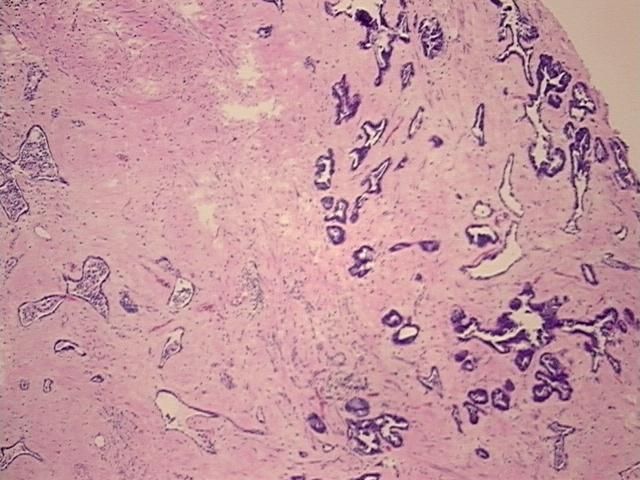 4x Image
