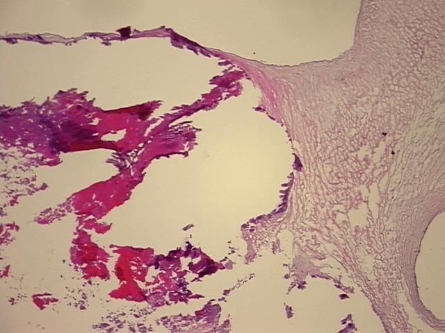 4x Image