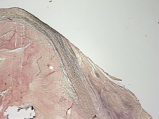 4x Image