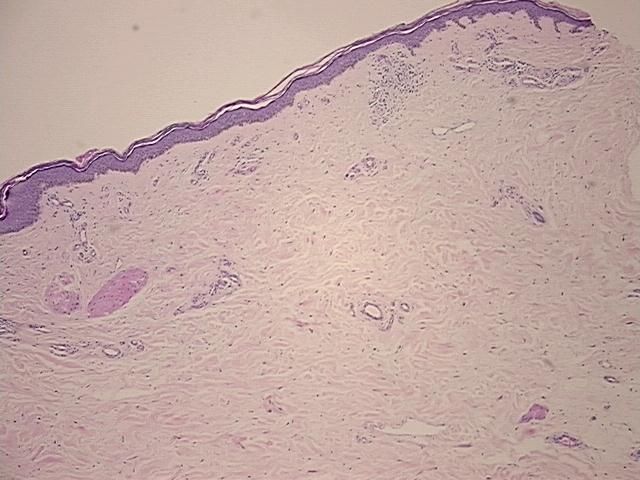 4x Image