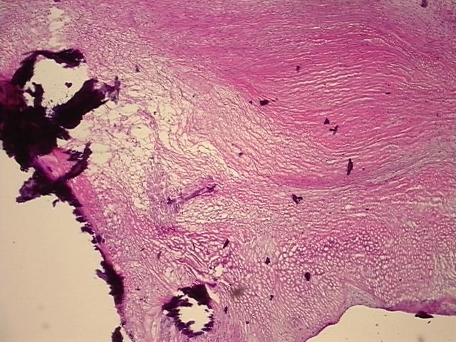 4x Image