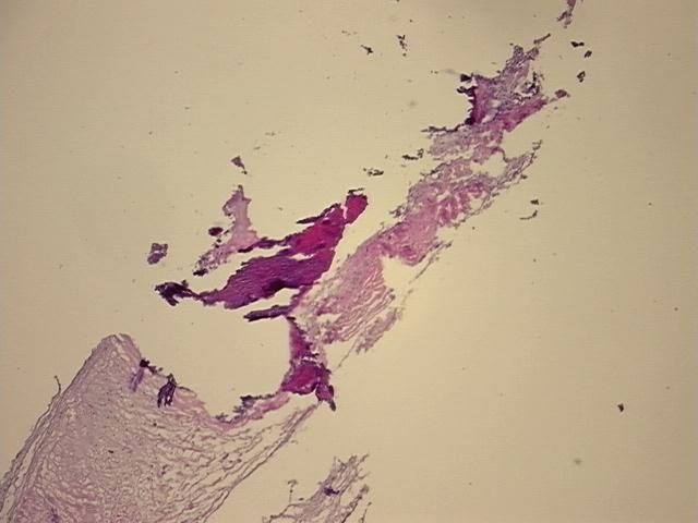 4x Image