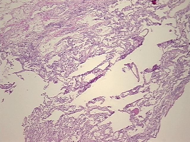 4x Image