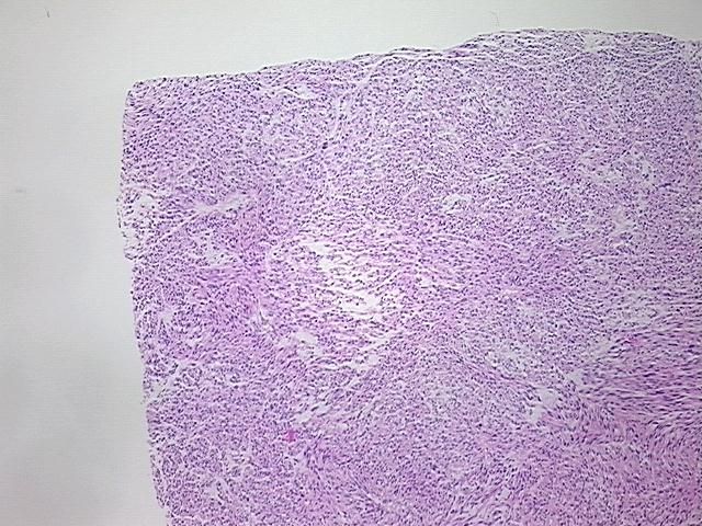 4x Image