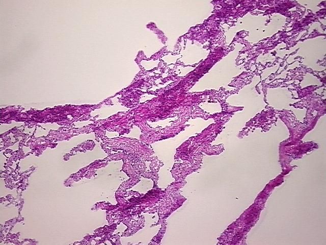 4x Image