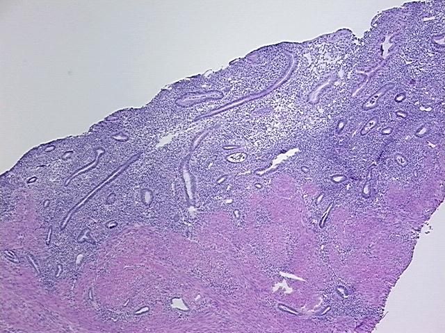 4x Image