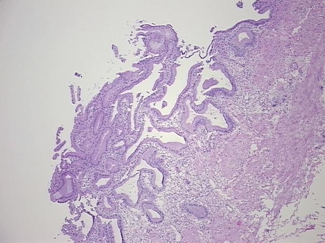 4x Image