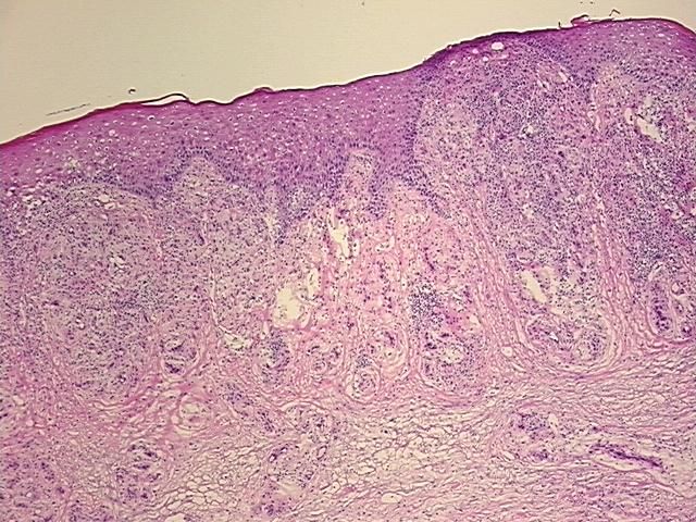 4x Image