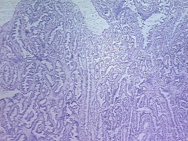 4x Image