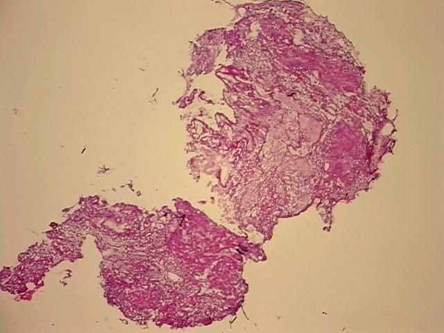 4x Image