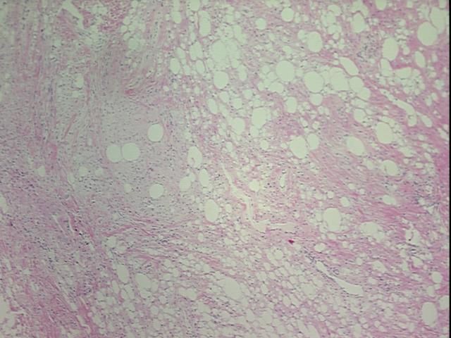 4x Image