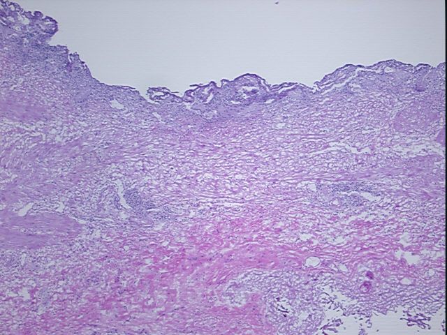 4x Image