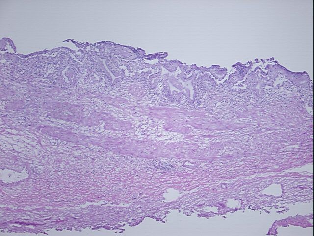 4x Image