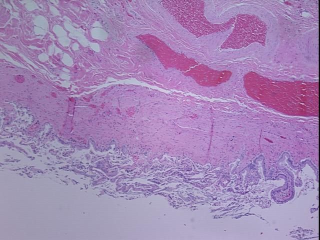 4x Image