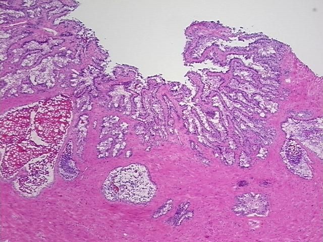 4x Image