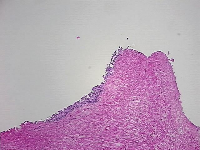 4x Image