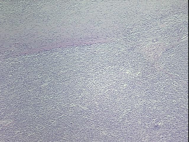 4x Image
