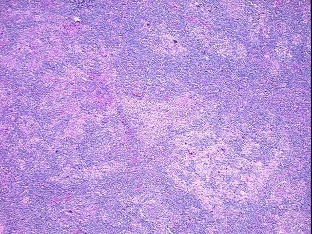 4x Image