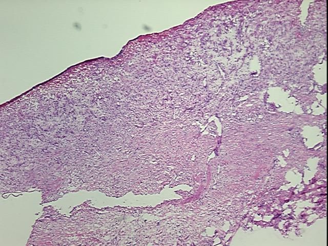 4x Image