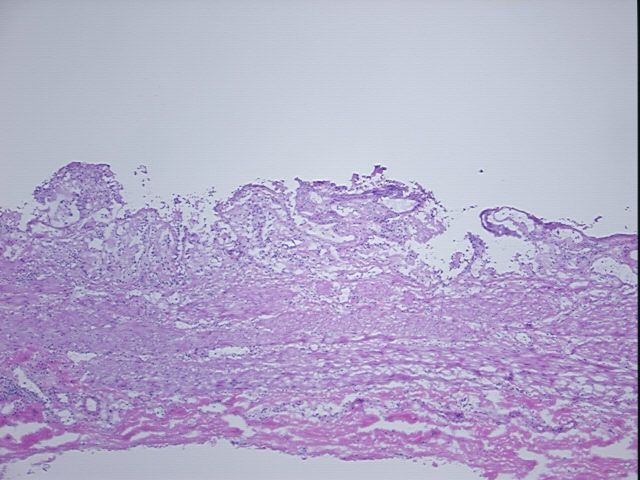 4x Image