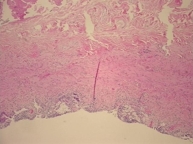 4x Image
