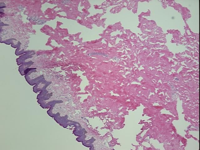 4x Image