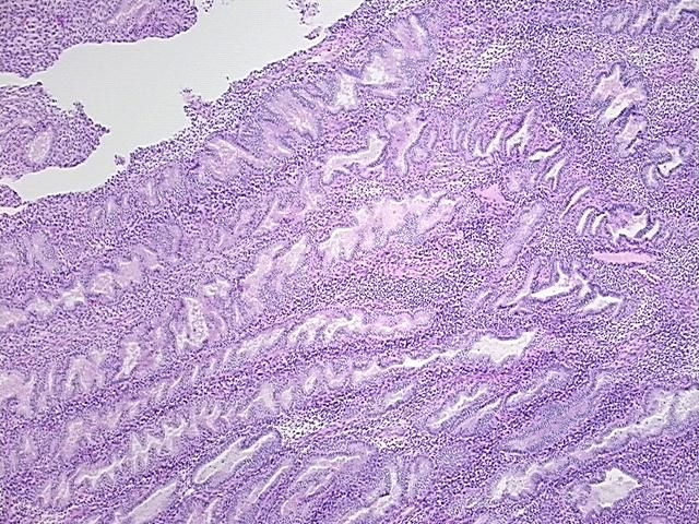 4x Image