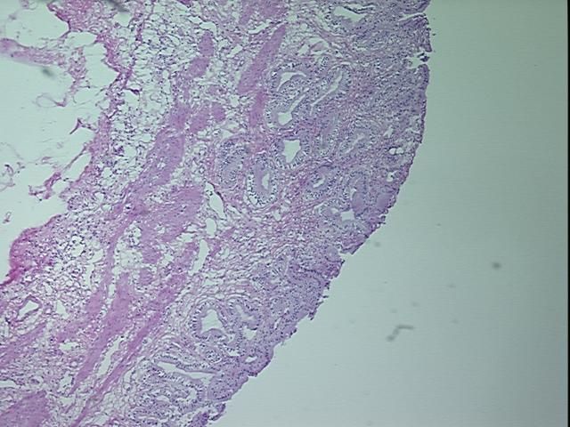 4x Image