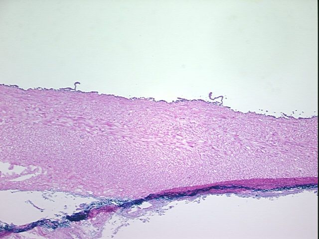 4x Image