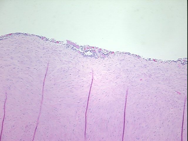 4x Image