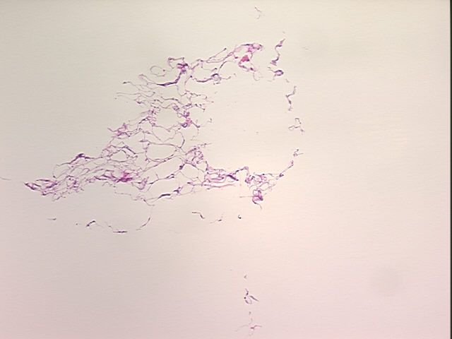 4x Image