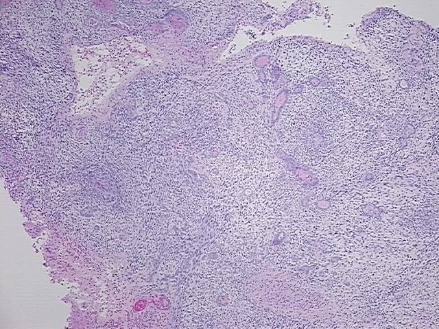 4x Image