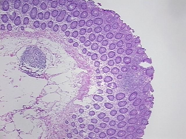 4x Image