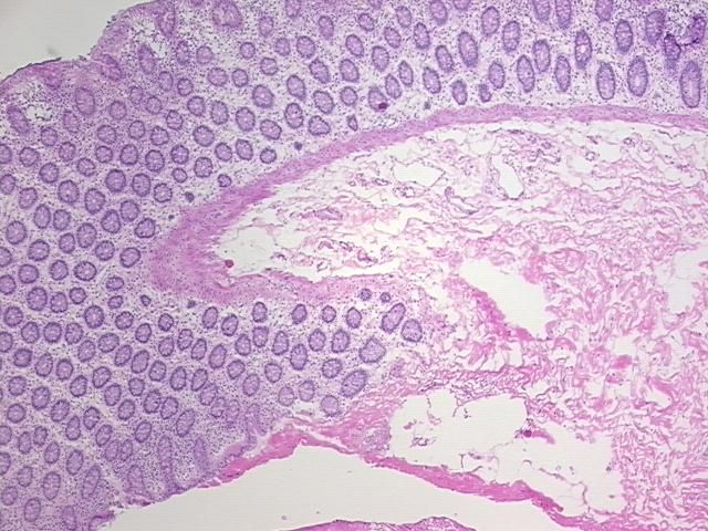4x Image