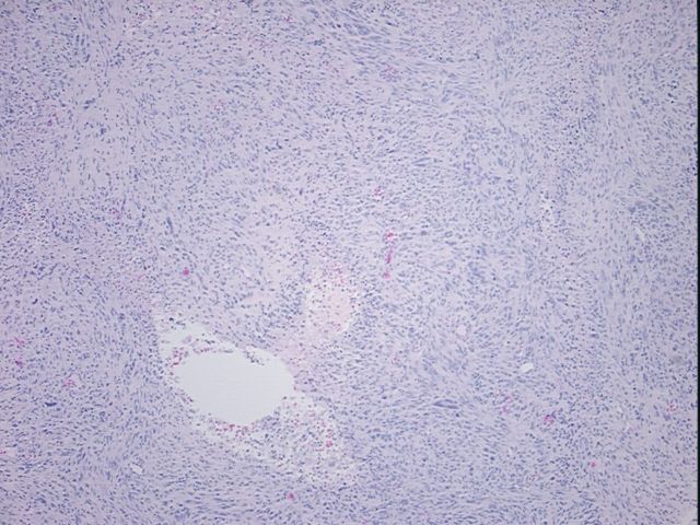 4x Image