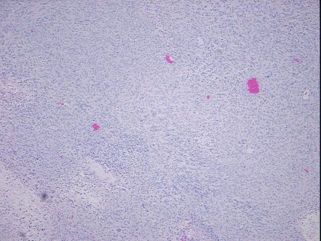 4x Image