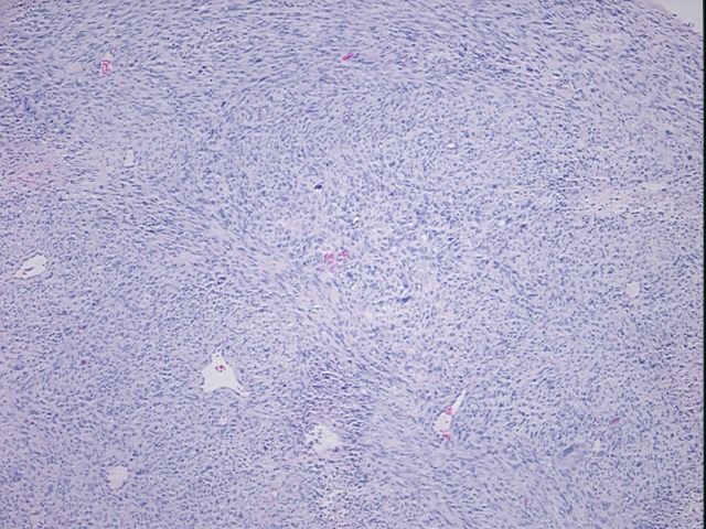 4x Image