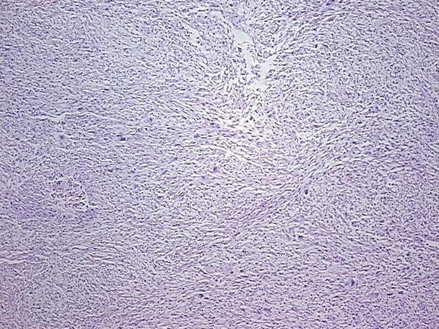 4x Image