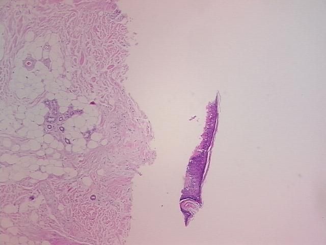 4x Image