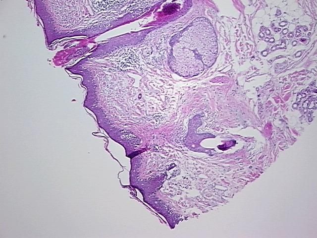 4x Image