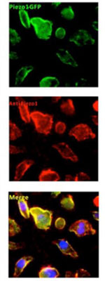 Mouse Anti-PIEZO1 Monoclonal Antibody – Cat# MBS435119