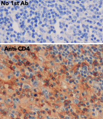 Goat Anti-CD4 Polyclonal Antibody, Immunochemistry (IHC) – Cat# MBS448011