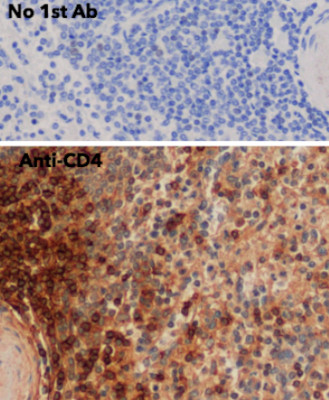 Goat Anti-CD4 Polyclonal Antibody, Immunohistochemistry (IHC) – Cat# MBS448011
