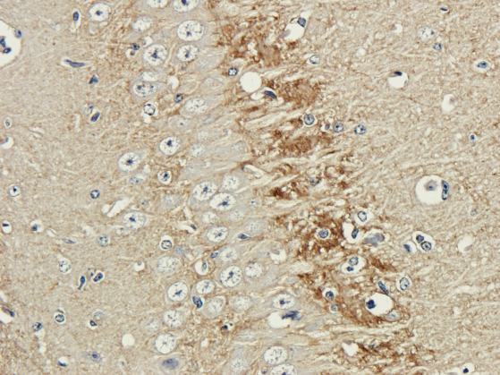 Rabbit Anti-Polysialic Acid Recombinant Antibody – Cat# MBS488177