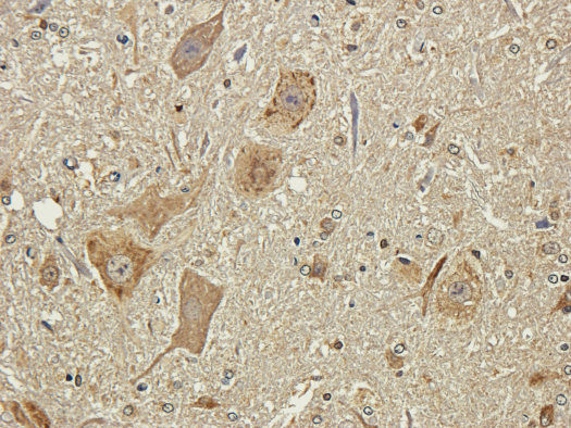 Rabbit Anti-Polysialic Acid Recombinant Antibody, Immunohistochemistry (IHC) – Cat# MBS488177