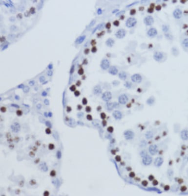 Rabbit Anti-H3K9me3 Antibody, Immunohistochemistry (IHC) – Cat# MBS126185