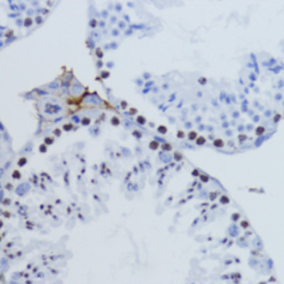 Rabbit Anti-H3K9me3 Antibody, Immunohistochemistry (IHC) – Cat# MBS126185