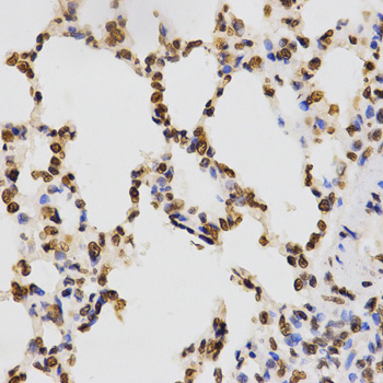 Rabbit Anti-H3K9me3 Antibody, Immunohistochemistry (IHC) – Cat# MBS126185
