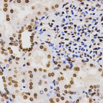 Rabbit Anti-H3K9me3 Antibody, Immunohistochemistry (IHC) – Cat# MBS126185